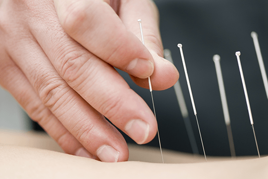 Smerte lindring akupunktur i Slagelse